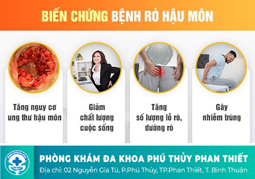 Rò hậu môn có nguy hiểm hay không?