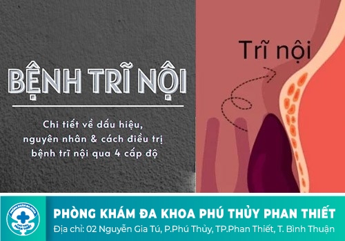 Biểu hiện nhận biết bệnh trĩ nội
