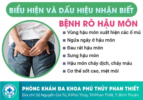 Dấu hiệu chứng minh bạn mắc bệnh rò hậu môn