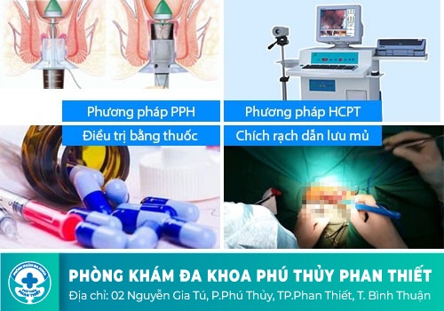 Những phương pháp hỗ trợ điều trị bệnh trĩ nội hiệu quả