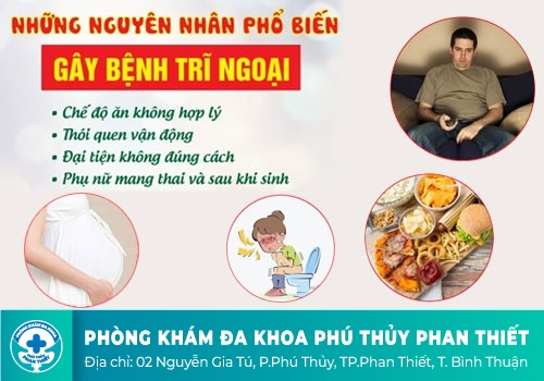Nguyên nhân dẫn đến bệnh trĩ ngoại