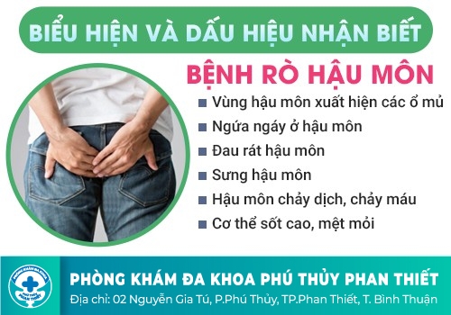 KHI BỊ RÒ HẬU MÔN CẦN PHẢI LÀM GÌ?