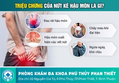 Nứt kẽ hậu môn