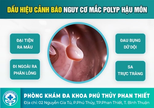  Polyp đại trực tràng