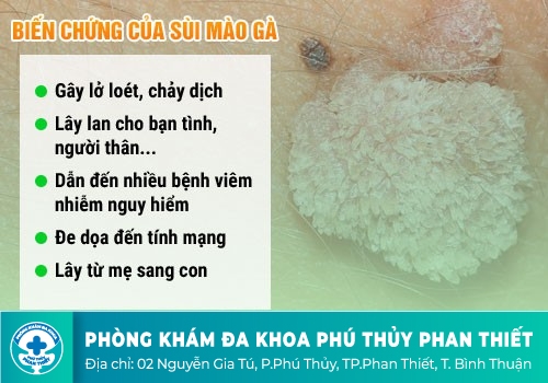 BIẾN CHỨNG NGUY HIỂM CỦA BỆNH SÙI MÀO GÀ Ở VÙNG KÍN