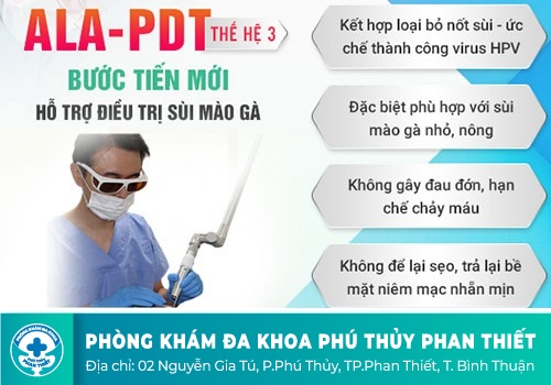 Địa chỉ hỗ trợ điều trị sùi mào gà nữ hiệu quả