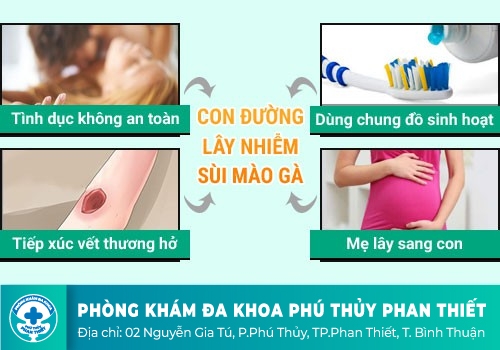 Nguyên nhân gây sùi mào gà ở nữ giới