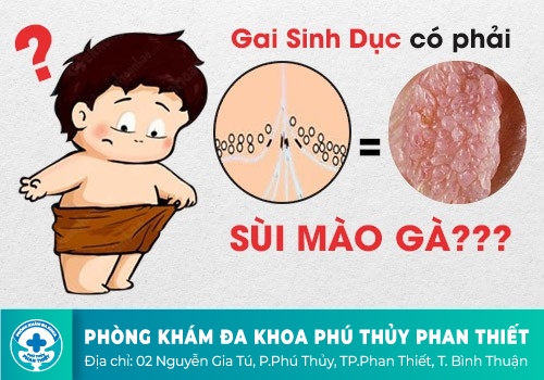 CÁCH PHÂN BIỆT GAI SINH DỤC VỚI SÙI MÀO GÀ
