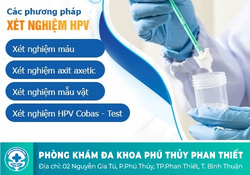 Quy trình xét nghiệm sùi mào gà