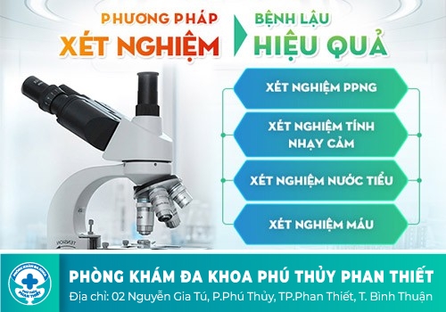 Xét nghiệm bệnh lậu ở đâu chính xác và đáng tin cậy?