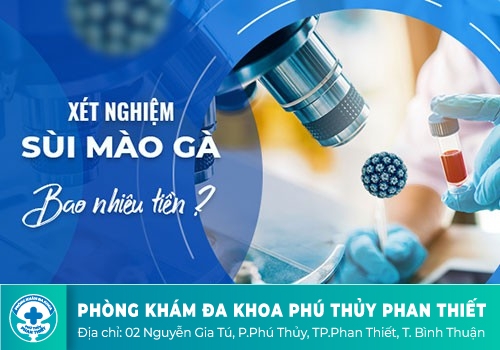 Chi phí xét nghiệm sùi mào gà hết bao nhiêu tiền? 