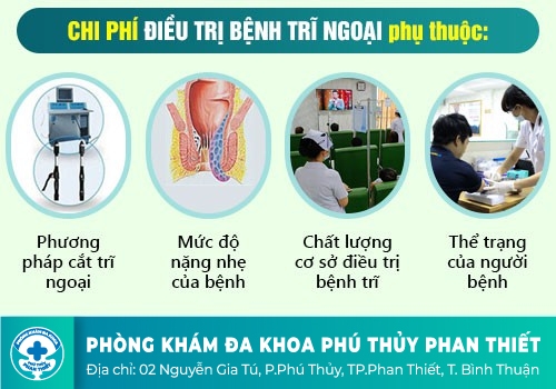 Chi phí hỗ trợ điều trị bệnh trĩ nội là bao nhiêu?