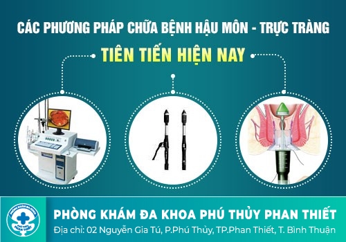 Trĩ nội độ 2, độ 3 có điều trị được không?