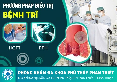 Chữa bệnh trĩ hỗn hợp như thế nào hiệu quả?