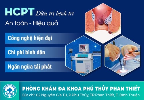 CÁCH CHỮA BỆNH TRĨ NGOẠI THỰC SỰ HIỆU QUẢ