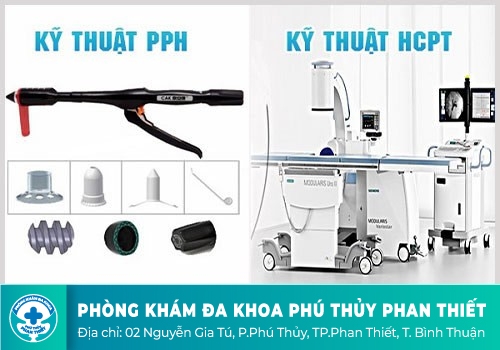 Điều trị trĩ nội hiệu quả bằng phương pháp đột phá mới