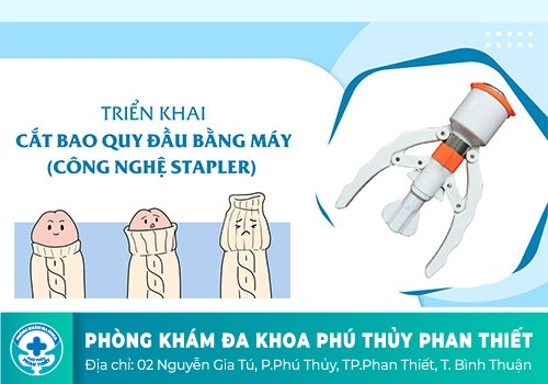 Cắt bao quy đầu bằng công nghệ Stapler – Surkon 