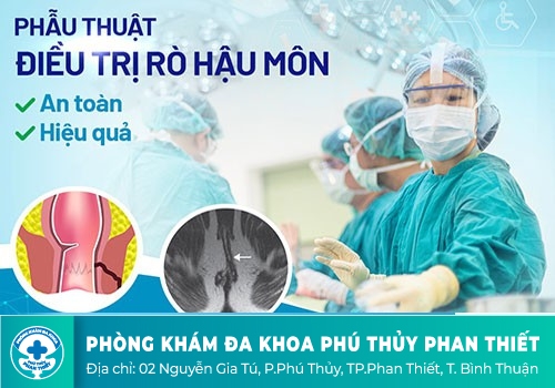 Chi phí phẫu thuật rò hậu môn bao nhiêu tiền?