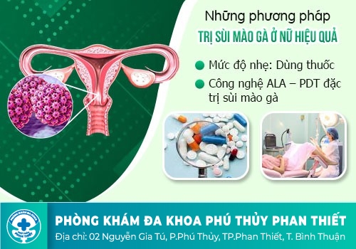CÁCH HỖ TRỢ ĐIỀU TRỊ GAI SINH DỤC, SÙI MÀO GÀ