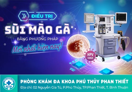 PHƯƠNG PHÁP HỖ TRỢ ĐIỀU TRỊ SÙI MÀO GÀ HIỆU QUẢ HIỆN NAY