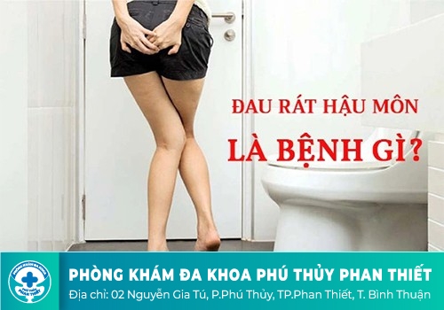 Chi phí hỗ trợ điều trị đau hậu môn, sưng hậu môn