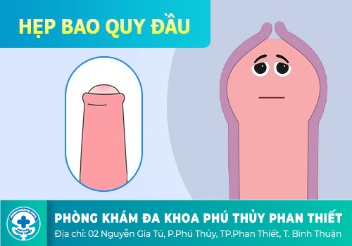 Hẹp bao quy đầu có quan hệ được không
