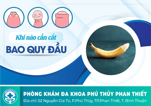 Khi nào cần cắt da bao quy đầu?