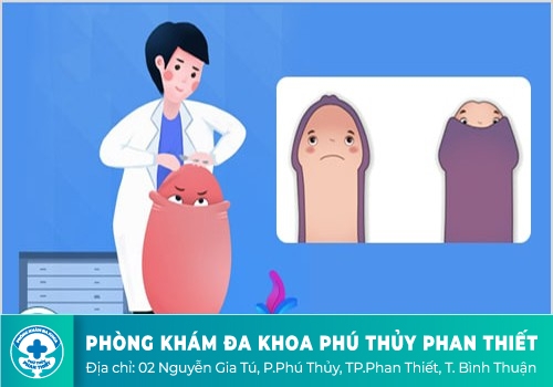 20 Tuổi Chưa Cắt Bao Quy Đầu Có Sao Không?