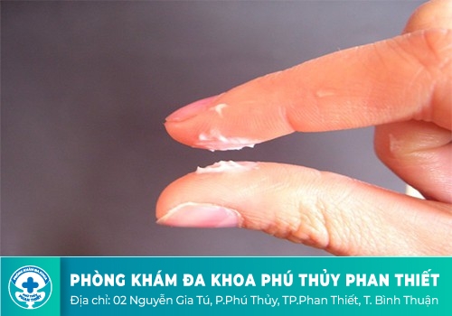 BIỂU HIỆN CỦA KHÍ HƯ BẤT THƯỜNG