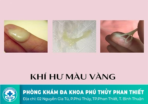 ra khí hư màu vàng 