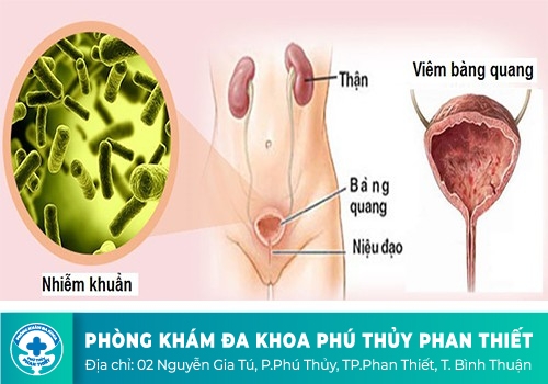7 dấu hiệu bạn phải đi khám bàng quang trước khi quá muộn