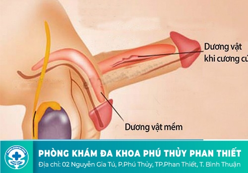 Dương vật bị đau khi cương cứng 