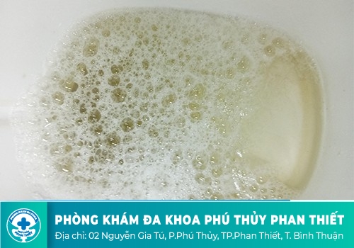 Nguyên nhân khiến nước tiểu có bọt