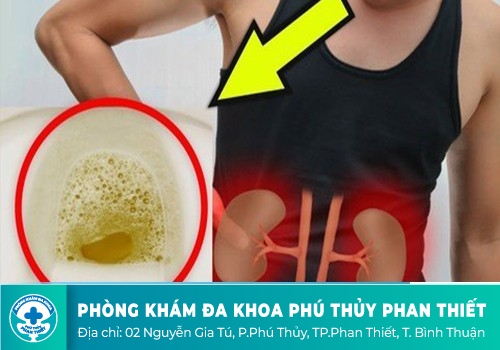 Nước tiểu đục