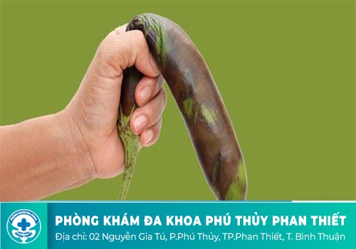 Dương vật, bao quy đầu bầm tím do đâu?