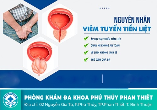 Nguyên nhân gây bệnh viêm tuyến tiền liệt ở nam giới