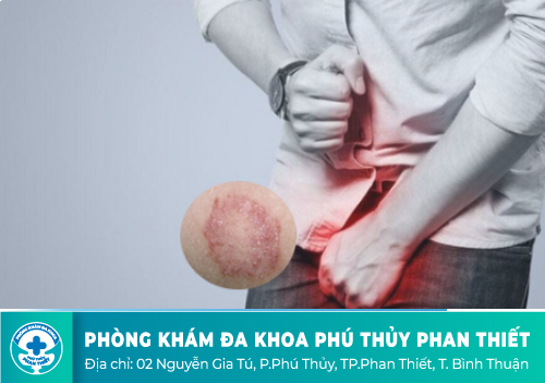 ngứa bên trong dương vật