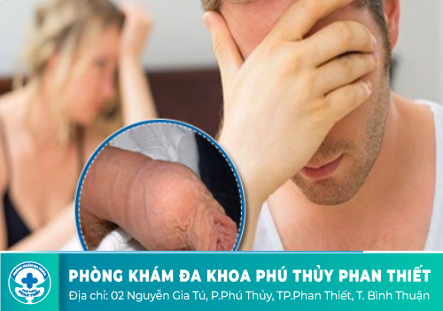 Bao quy đầu chưa lột có quan hệ được không?