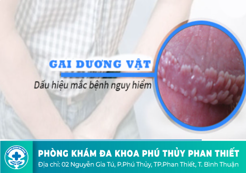 Dấu hiệu nhận biết gai dương vật ở nam giới