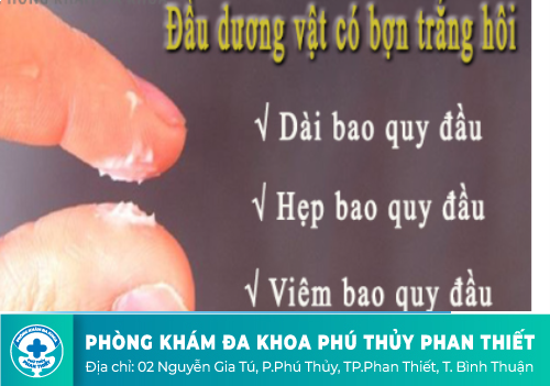 Nguyên nhân xuất hiện bợn trắng quy đầu