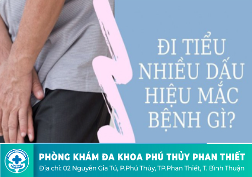 Đi tiểu nhiều là triệu chứng của bệnh gì?
