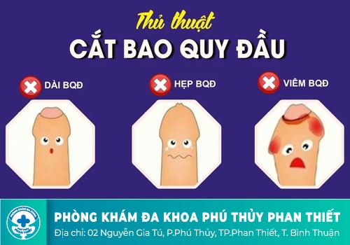 Các bệnh về vùng kín thường gặp ở nam giới