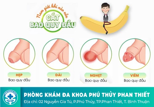 Khi nào cần cắt bao quy đầu?