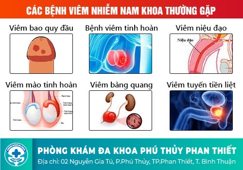 CÁC BỆNH LÝ NAM GIỚI THƯỜNG GẶP NHẤT LÀ GÌ