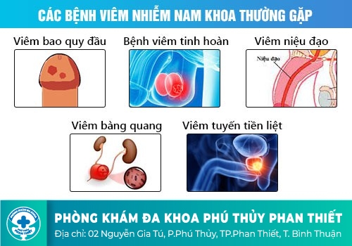 Khám nam khoa là khám những bệnh gì?