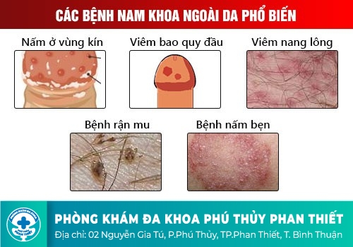 Những bệnh nguy hiểm ở cậu nhỏ mà các chàng nhất định phải biết