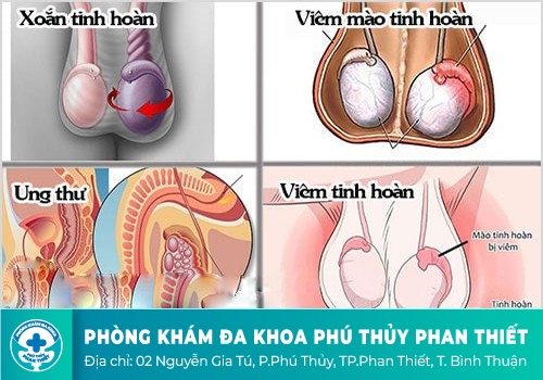Các bệnh lý tinh hoàn thường gặp 