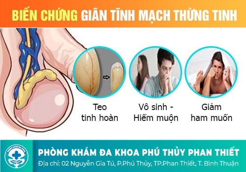 ĐAU TINH HOÀN CÓ BIỂU HIỆN RA SAO?