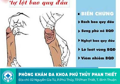 Tại sao nam giới trưởng thành không lột bao quy đầu?