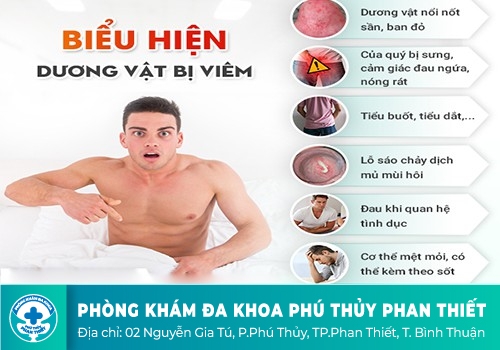 Các bệnh ở bộ phận sinh dục nam phổ biến hiện nay